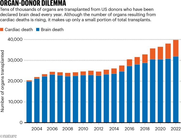 Sunday Science: What Does 'Brain Dead' Really Mean? The Battle