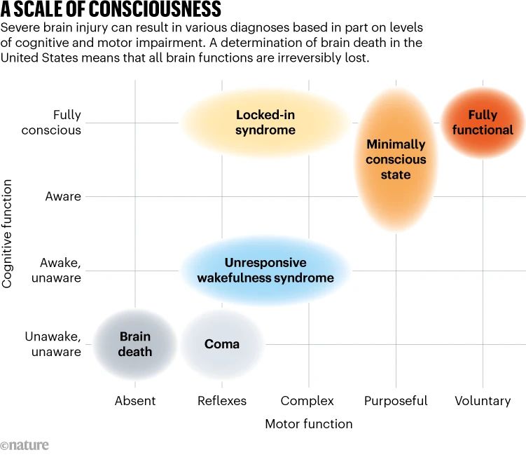 Harvard Panel Asks Definition of Death Be Based on Brain; DEATH REDEFINED  BY HARVARD PANEL - The New York Times