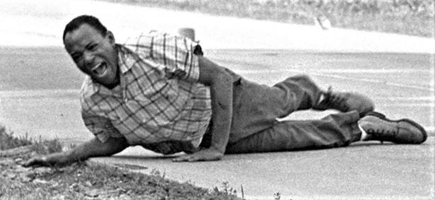 Civil rights activist James Meredith wincing in pain just after he was wounded by a sniper