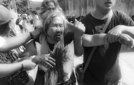 beaten and injured activist from Filipino demonstration